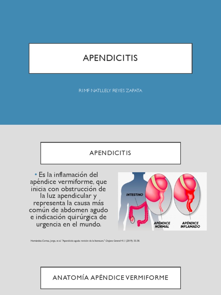 apendicitis-pdf-especialidades-medicas-medicina-clinica