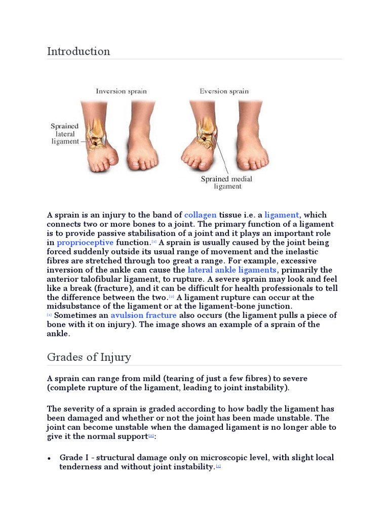 Ligament Sprain Biology Diagrams