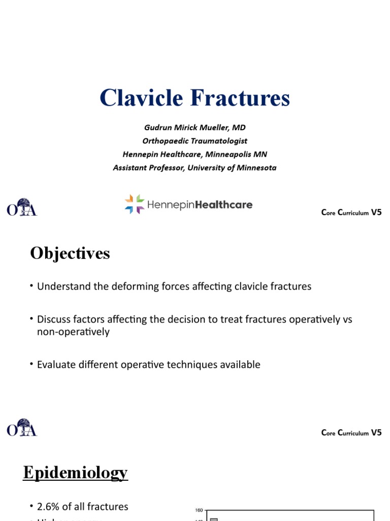 UE 1 Clavicle Fractures | PDF | Skeletal System | Human Anatomy