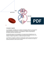 Cardiopatía