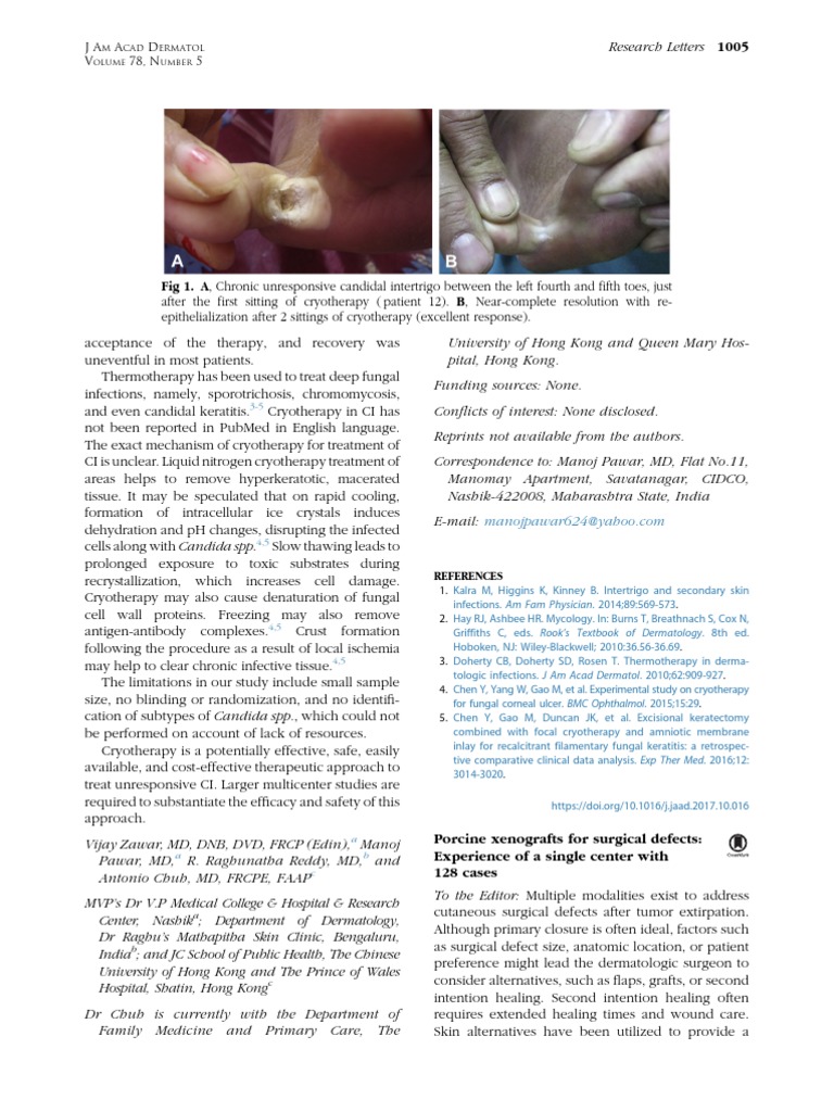 PORCINE XENOGRAFTS FOR SURGICAL DEFECTS (2017) PDF