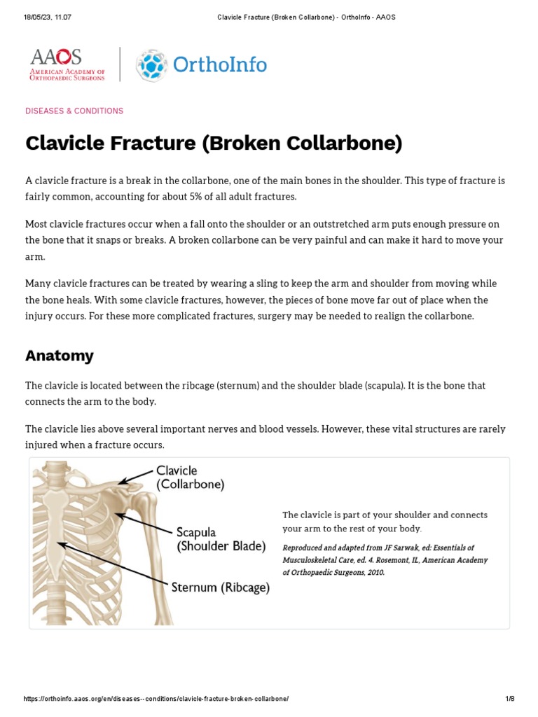Clavicle Fracture Treatment Guidelines | PDF | Injury | Medicine