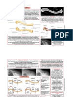 Fractura de Clavicula