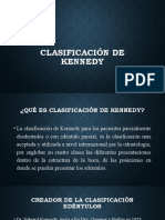 Clasificacion de Kennedy y Modificaciones Applegate