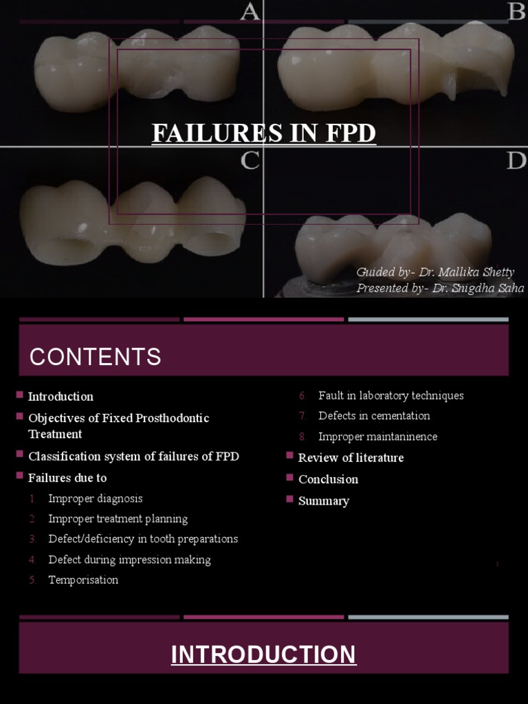 Understanding FPD Failures and Classifications | PDF | Periodontology ...