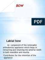 Labialbows (Cung Môi Khí C )