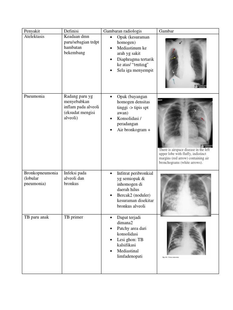 Radiologi Gambar | PDF