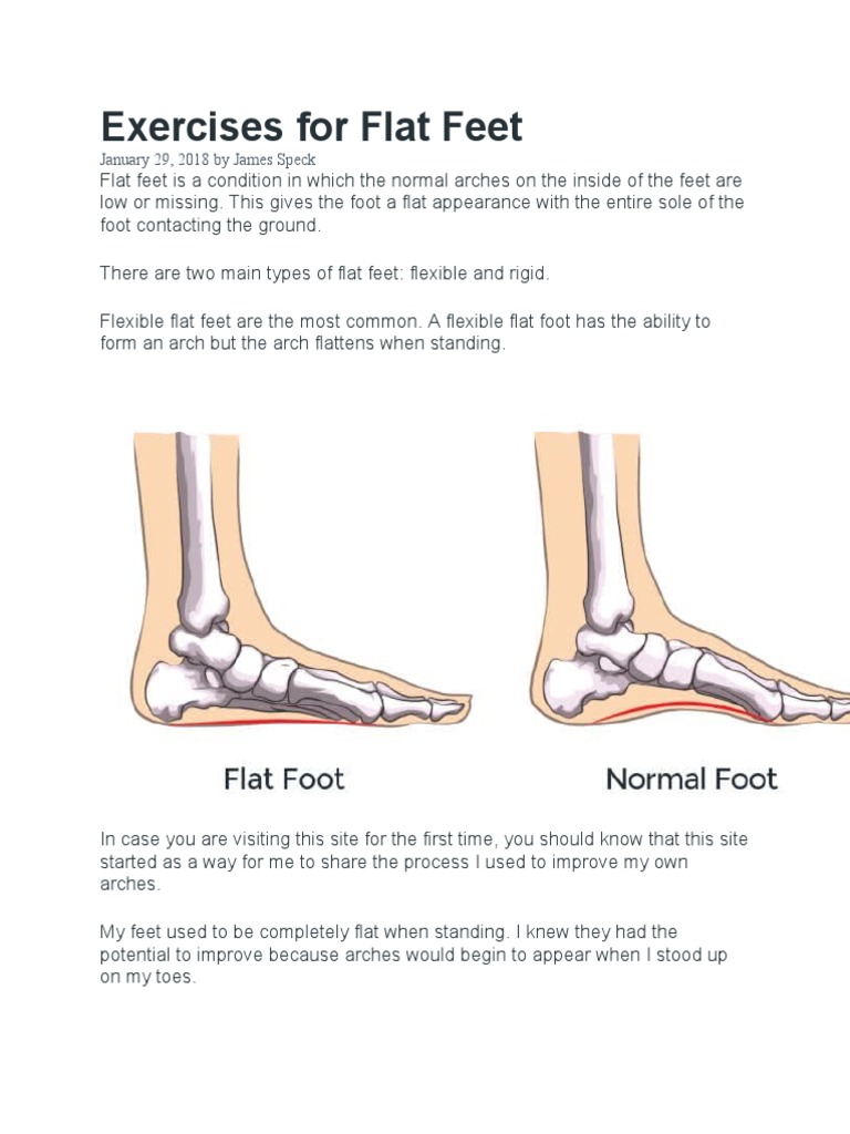 Exercises For Flat Feet PDF