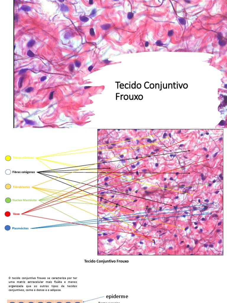 Características do Tecido Conjuntivo Frouxo | PDF | Tecido conjuntivo ...