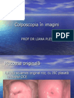 Colposcopiainimagini