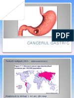 Cancer Gastric El
