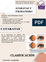 Cataratas y Astigmatismo