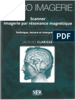 neuro imagerie scanner irm SFR