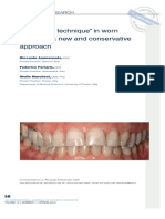 The “Index Technique” in Worn Dentition- A New and Conservative Approach