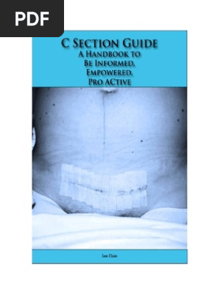 C-Section Guide 