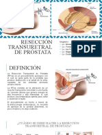 Resección Transuretral de Próstataa