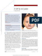 An Overview of Cleft Lip and Palate.3