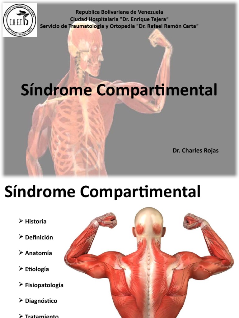 Sindrome Compartimental UAM | PDF | Isquemia | Medicina CLINICA