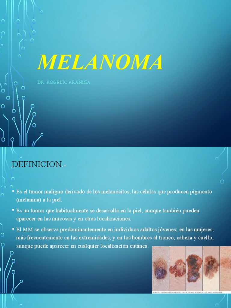 Un Ejemplo De Un Informe De Patología Del Melanoma – DTHK