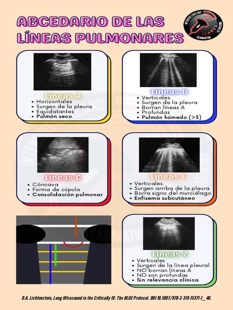 Protocolo BLUE en Ecografía Pulmonar | PDF