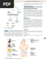 Forrest Classification of GI Bleeding | PDF
