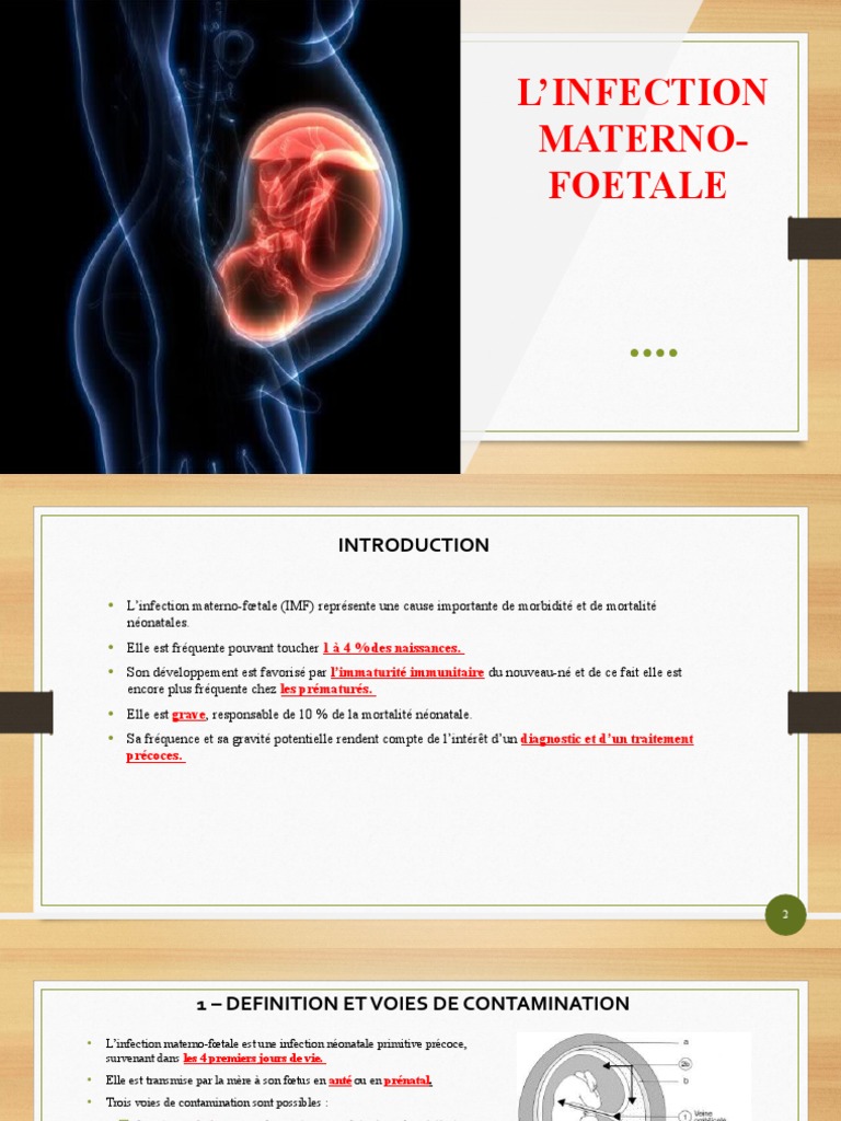 L'infection Materno Foetale | PDF