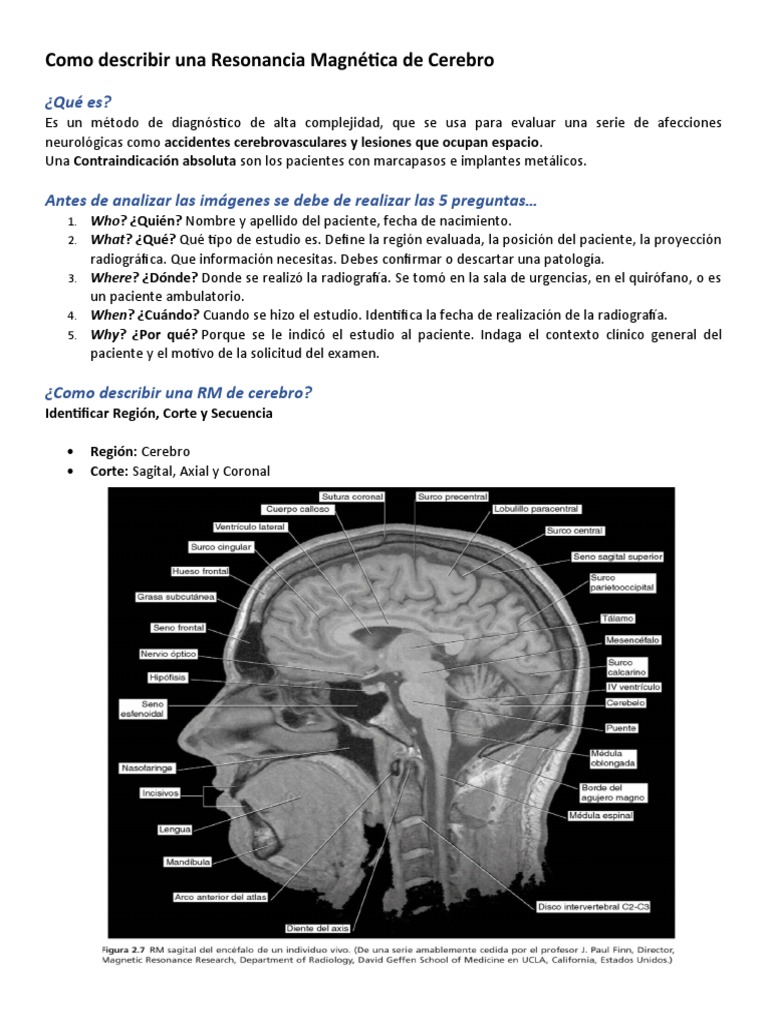 Como Describir Una Resonancia Magnética de Cerebro | PDF, image size:768x1024