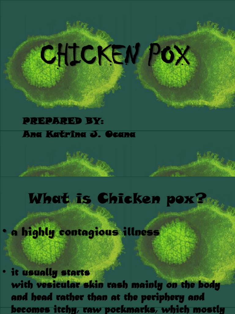 Chicken Pox Pdf Immunology Diseases And Disorders