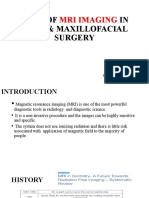 Role of IN Oral & Maxillofacial Surgery: Mri Imaging