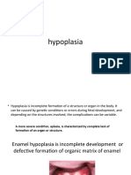 Hypoplasia 1