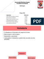 Hematuria