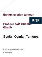 Benign Ovarian Tumour
