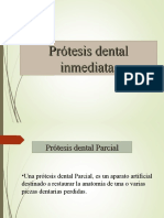 Clase PrÃ Tesis Dental Inmediata