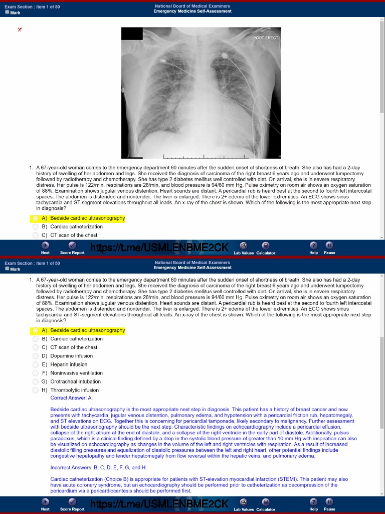 洋書 Self-Assessment in Chest Medicine 洋書 Self-Assessment in Chest Medicine Amazon.com: Self