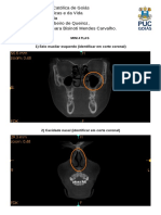 Mini Atlas Radiologia