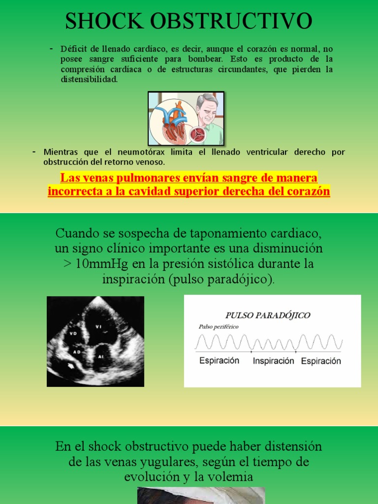 Fisiopatología y Tratamiento del Shock Obstructivo | PDF