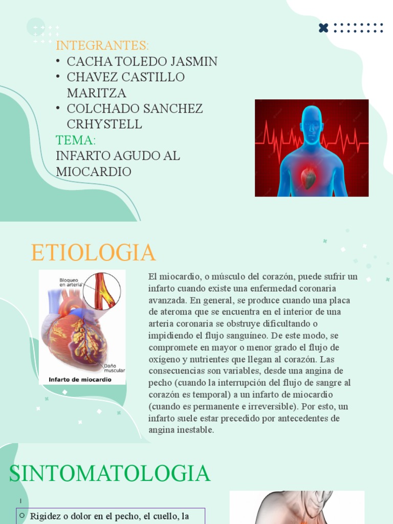 Infarto Agudo de Miocardio | PDF | Infarto de miocardio | Corazón