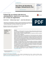 Prótesis Fija Con Sistema Tubo-Barra