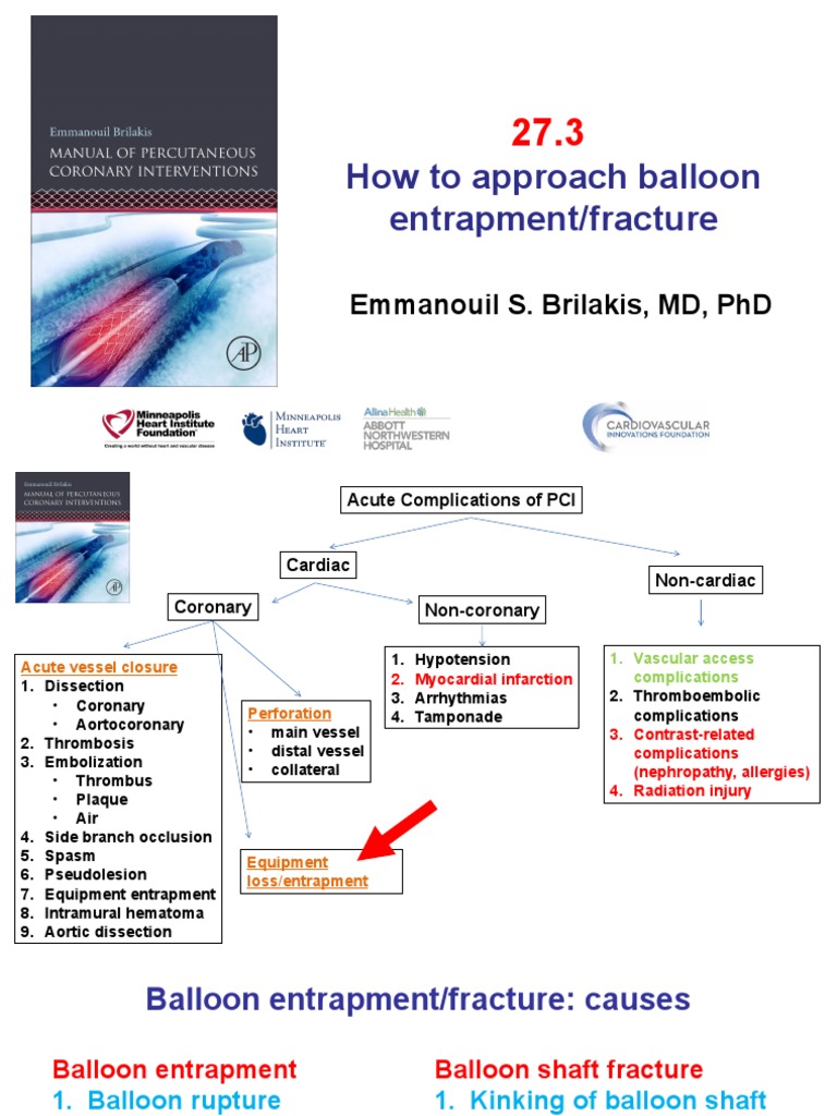 27.3 Balloon Entrapment Fracture | PDF