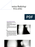 Expertise Radiologi Tulang Dan SPN