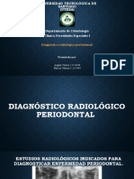 Diagnóstico Radiológico en La Enfermedad Periodontal