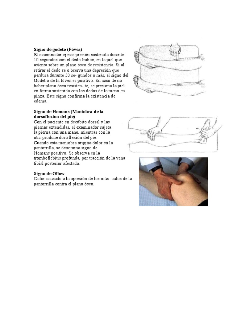 Signos de Homans y Ollow en Edema | PDF
