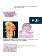 Examen de Neoplasias