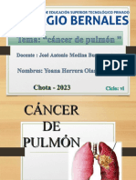 Cancer Pulmonar