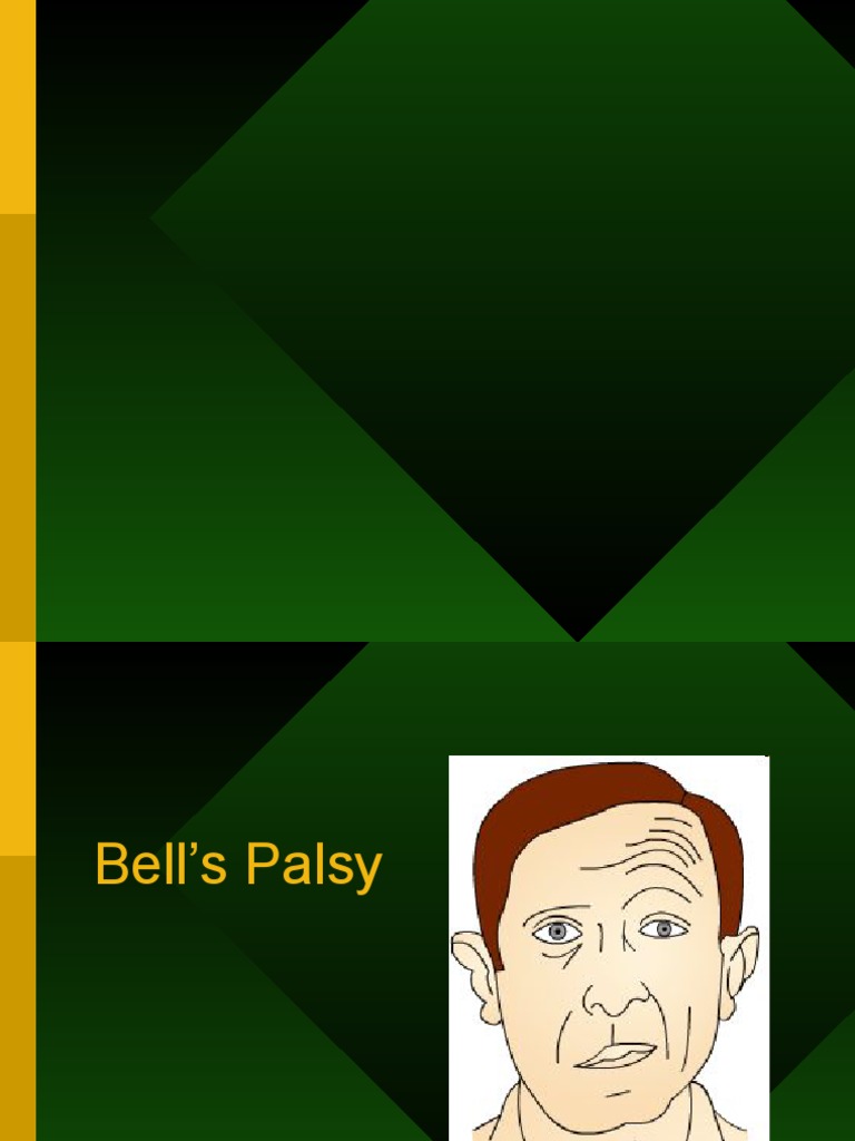 Bells Palsy PDF(01)