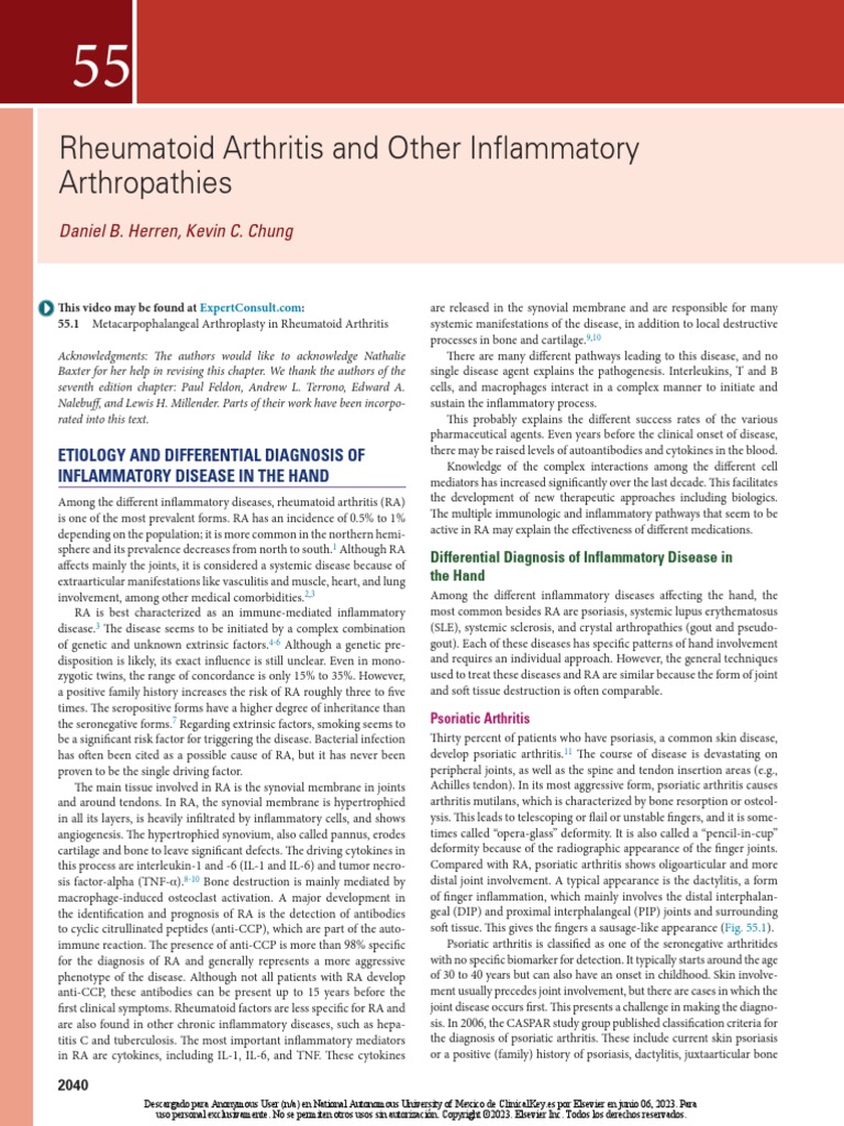 rheumatoid-arthritis-and-other-inflammatory-arthropathies-daniel-b