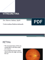 Retina