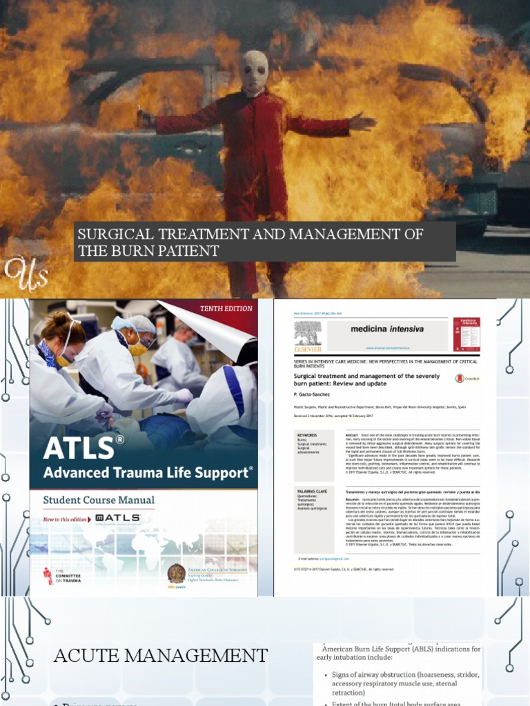 Management of Burn PDF Burn Wound