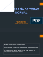 Radiografia de Torax Normal