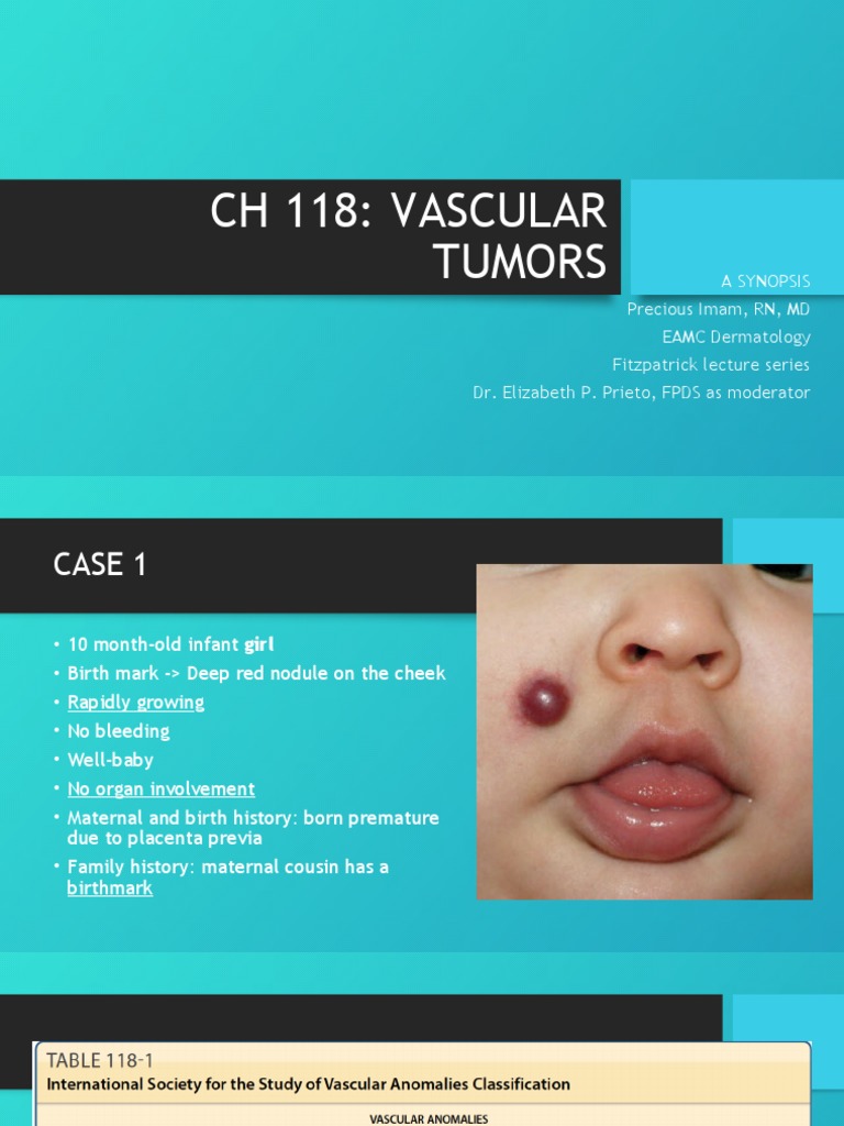 Vascular Tumors Fitz Lec PDF Medical Specialties Clinical Medicine